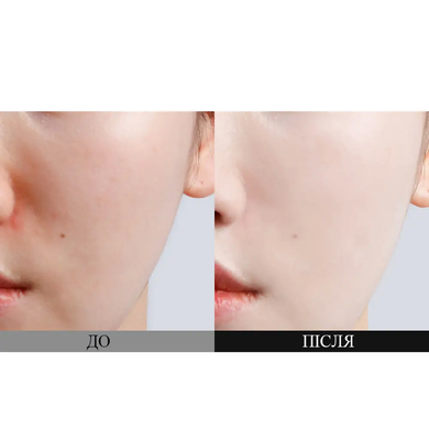 Dr.Ceuracle Крем для обличчя сонцезахисний освітлюючий з пробіотиками Pro Balance Biotics SPF50 50мл : Dr.Ceuracle : УТП009633: 4