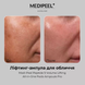 MEDI-PEEL Сироватка для обличчя з ліфтинг-ефектом Peptide 9 Volume Lifting All In One Podo Pro 30ml : Medi-Peel 3