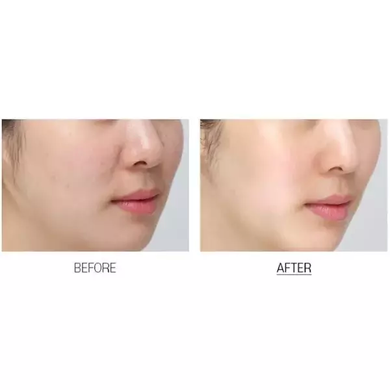 MEDI-PEEL Тканинна маска для обличчя з вітаміном C Vitamin Bomb Refreshing Mask 25мл : Medi-Peel : УТП009750: 5