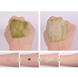MEDI-PEEL Гель для глибокого очищення шкіри з ефектом детоксу Algo-Tox Deep Clear 150 мл : Medi-Peel 4